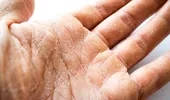 Pui prea multe rufe la spălat? Poate fi motivul pentru care ai pielea uscată. 7 greșeli de evitat pentru a preveni iritația și uscăciunea pielii