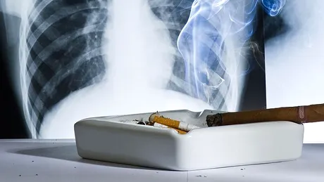 Fumătorii care preferă acest tip de ţigări au un risc mult mai mare de a face cancer!