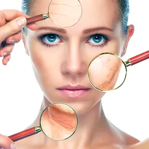 Melasma – cea mai răspândită afecțiune post- sezon cald
