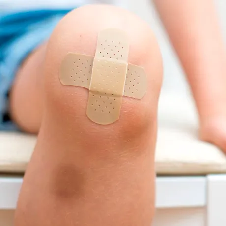 Vânătăile inexplicabile la copii: când ar trebui să te îngrijoreze că ar indica o problemă de sănătate
