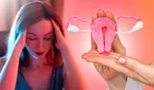 Legătura dintre endometrioză și cancerul ovarian. Ce simptome recomandă medicii să urmărești