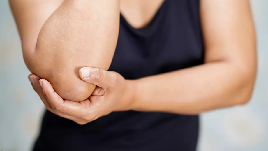 Semnul ciudat din cot că ai prea mult acid uric în sânge