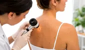 (P) Alunițe, pete, mâncărimi sau leziuni care nu se vindecă: ce modificări ale pielii ar trebui evaluate de dermatolog