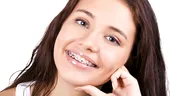 Cum obţii un zâmbet frumos şi sănătos? De ce nu este scump un aparat dentar?
