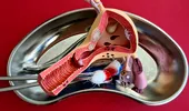 Ce să mănânci dacă ai trecut printr-o histerectomie. Alimente vindecătoare care te ajută să-ți recapeți forța