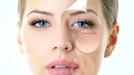 Ce probleme de sănătate ai în funcție de locul în care îți apar riduri