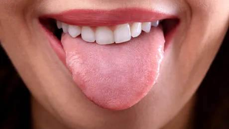 Ce spune culoarea limbii despre starea ta de sănătate