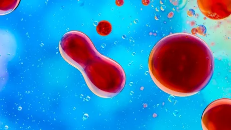 Poate muzica să lupte împotriva cancerului? Cercetătorii brazilieni testează efectele surprinzătoare ale sunetului asupra celulelor canceroase