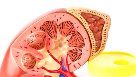 Rinichiul polichistic: simptome, cauze, tratament