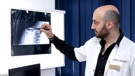 De ce te dor genunchii și coloana vertebrală când plouă? Explică dr. Tarek Nazer