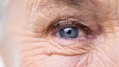 Glaucomul nu doare, dar duce la orbire! Vezi care sunt simptomele şi cine prezintă un risc crescut