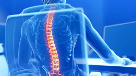 Postura vicioasă a coloanei vertebrale: cauze şi soluţii