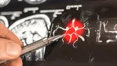 O moleculă din creier ar putea alimenta boala Alzheimer. Studiile au evidențiat un „comutator” al inflamației
