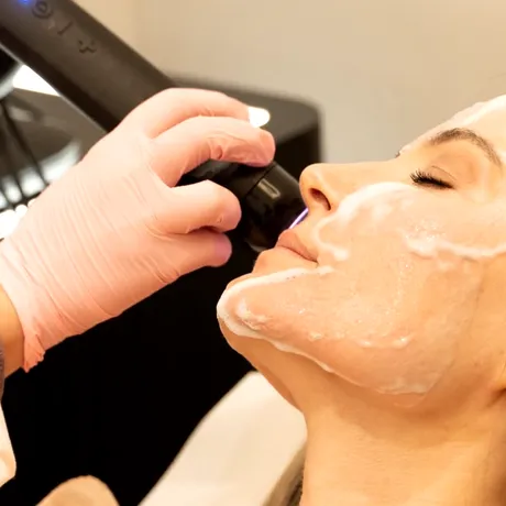 Ai 25 de ani și nu ai riduri încă? Dermatologii spun că acum este momentul perfect pentru prevenție
