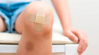 Vânătăile inexplicabile la copii: când ar trebui să te îngrijoreze că ar indica o problemă de sănătate