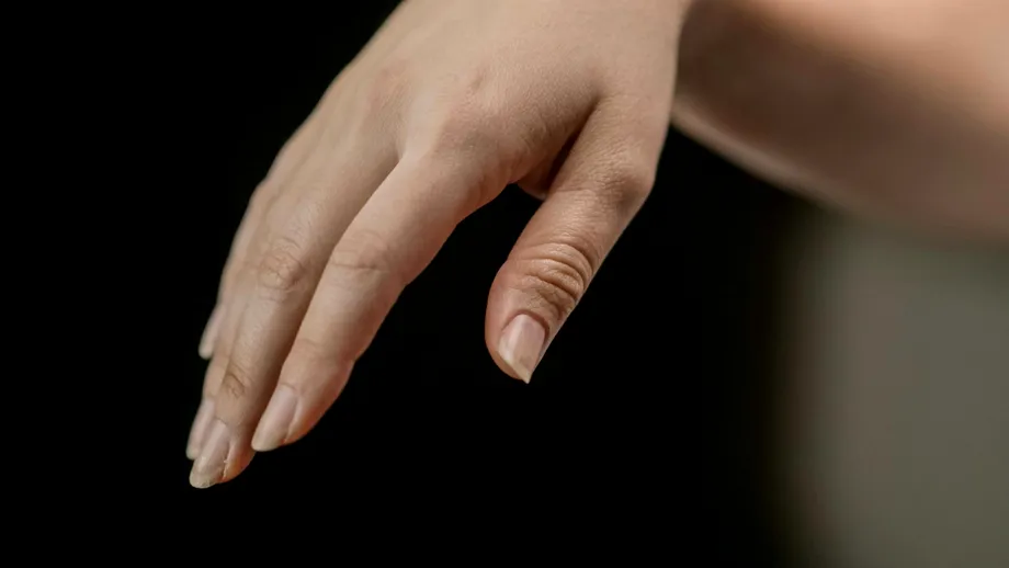(P) 5 semne că ai nevoie de colagen – și cum să îl alegi pe cel potrivit