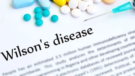 Boala Wilson: simptome, tratament