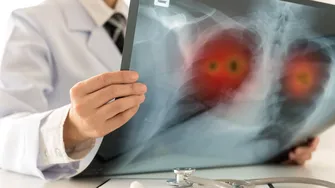 De ce foștii fumători rămân vulnerabili la bolile pulmonare. Ce se întâmplă în plămâni după ce renunți la țigări