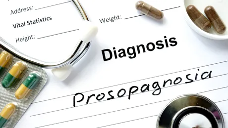 Prosopagnozia: ce este și cum se manifestă această boală rară  