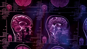 Tremorul mâinilor, problemele de memorie sau schimbările de comportament pot ascunde afecțiuni neurologice. Ce semnale nu ar trebui ignorate