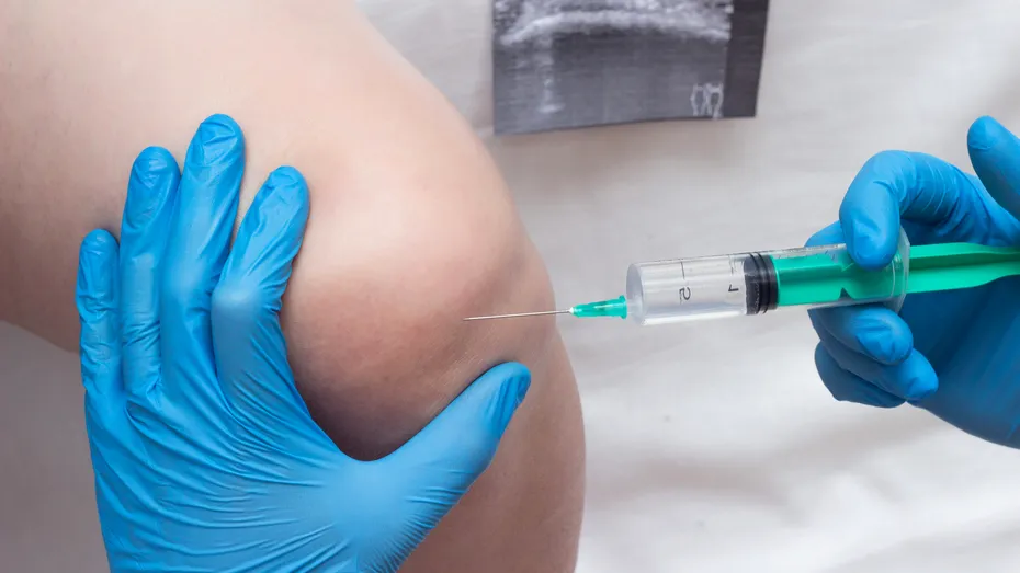 5 semne de gonartroză. Cum se tratează artroza genunchiului în funcție de stadiul bolii