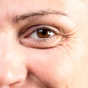 Riduri și realitate. Sunt ele semne ale îmbătrânirii sau ale unei vieți trăite intens?