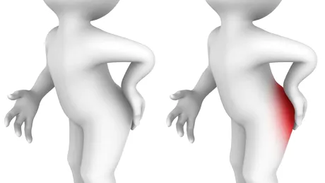 Hemoroizii: simptome, tratament