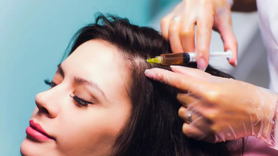 Cum funcționează mezoterapia pentru piele și scalp