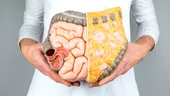 Semne ale cancerului de colon la tineri. Avertismentul transmis de un medic gastroenterolog