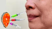 Tehnica bizară la care apelează femeile pentru o față ca de bebeluș. Își injectează lichid seminal de somon, în loc de botox, să scape de riduri