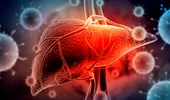 Tot ce știm până acum despre hepatita misterioasă. Ce se întâmplă cu ficatul în cazul hepatitei