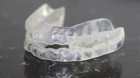 Ce trebuie să știi dacă urmează să porți un aparat dentar invizibil pentru adulți