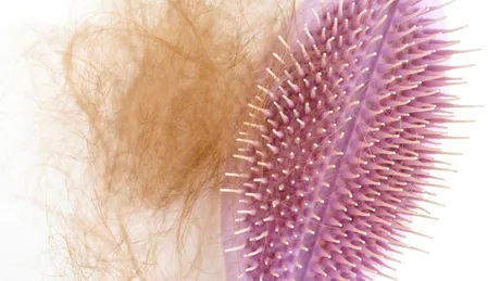 Căderea părului după COVID: care sunt cauzele, cât durează, ce soluții există