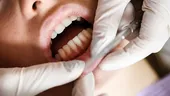 (P) Sângerarea gingiilor: Un semnal de alarmă pe care nu trebuie să-l ignori