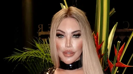 Fostul Ken, apariție de senzație după o nouă intervenție. Și-a subțiat fața