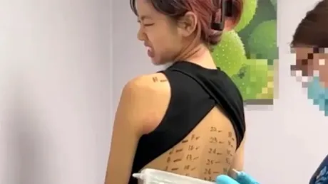 Această tânără este alergică la... aproape orice! Poate muri în orice moment