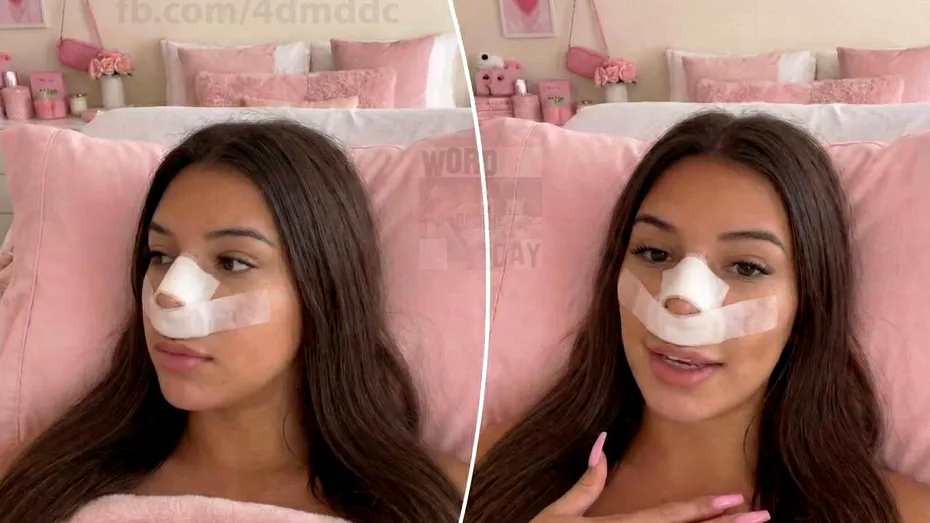 Influencerița care și-a făcut rinoplastie pentru ca viitorii copii „să nu-i moștenească nasul