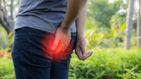Semnele comune pentru hemoroizi și cancer anal: o mulțime de oameni le au!