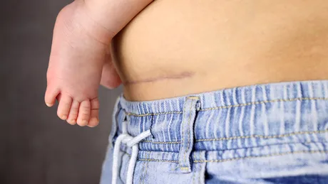 ȘOCANT! Ce au descoperit medicii în burta unei femei, la un an și jumătate după ce a născut