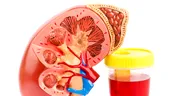 Urina cu sânge - ce afecțiuni ale rinichilor ascunde acest simptom