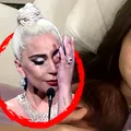 Boala groaznică de care suferă Theo Rose. Lady Gaga a avut aceeași problemă ca vedeta Pro TV