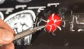 Ce se întâmplă când te repeți sau pui aceeași întrebare de mai multe ori. Problema de memorie la care te aștepți cel mai puțin