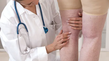 Varicele: riscuri majore şi tratament rapid - VIDEO by CSID