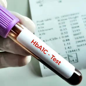 De ce poate crește hemoglobina glicată (HbA1c)? Glicemia ridicată nu este singura explicație