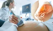Morfologia fetală de trimestrul 2: când se face, cum te pregătești, ce anomalii poate depista