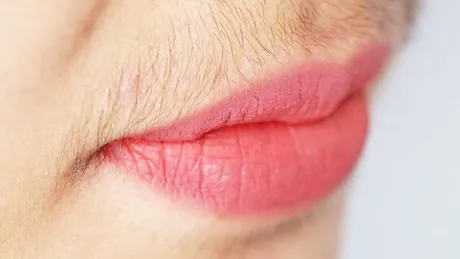 Excesul de androgeni (hiperandrogenism): cauze, simptome, tratament