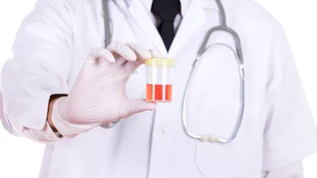 Hematuria (urinare cu sange)