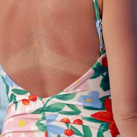 Dr. Andreea Domnițeanu, medic dermatolog: Nu există bronz natural și sănătos atunci când vorbim despre expunerea la soare