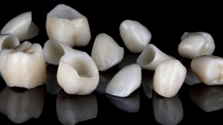 (P) Coroanele dentare explicate: ce trebuie să știi despre fiecare tip