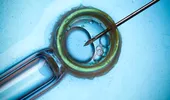 Fertilizarea in vitro: despre mama surogat şi rejuvenarea ovarelor